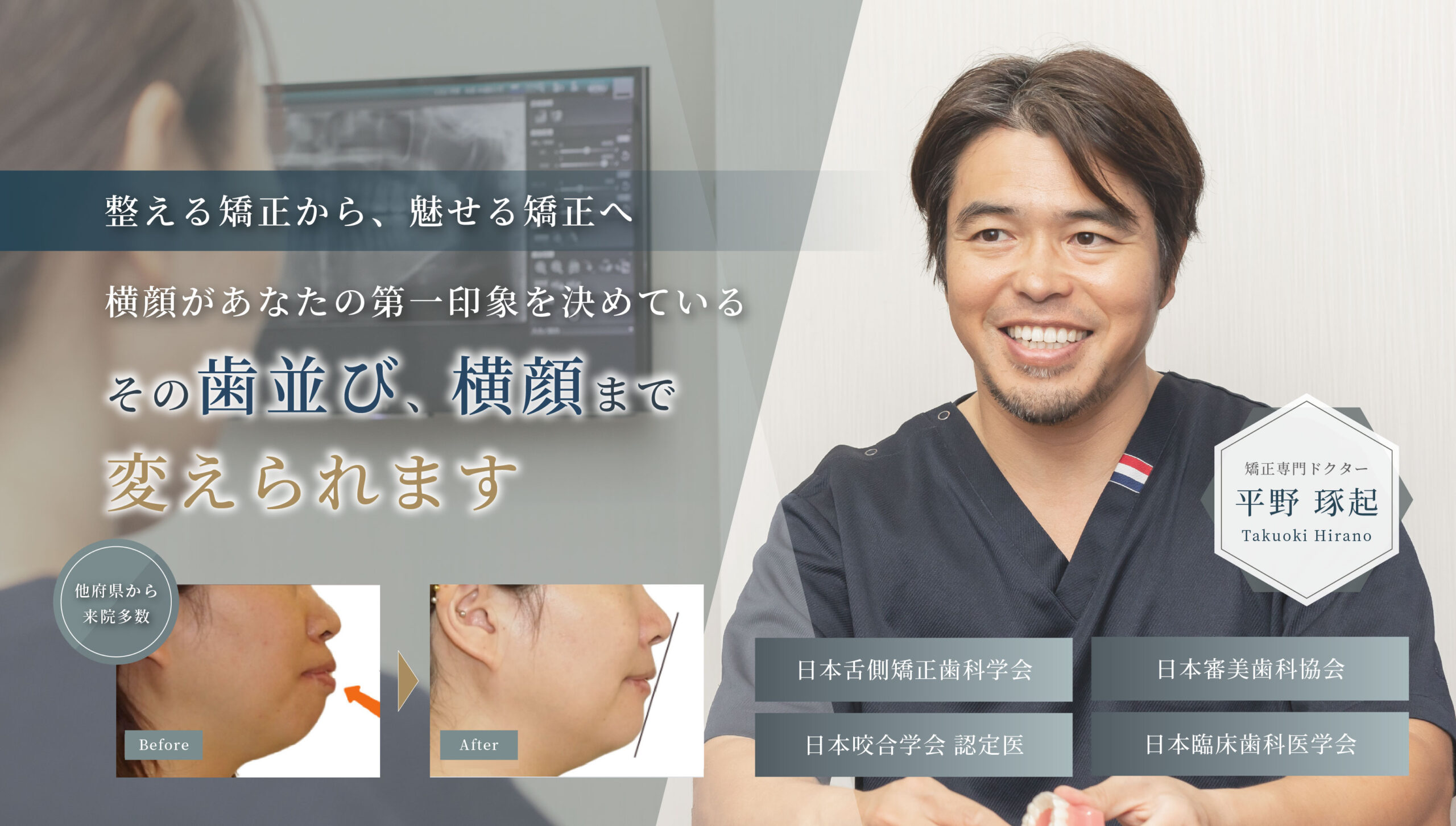 綺麗に整う矯正歯科